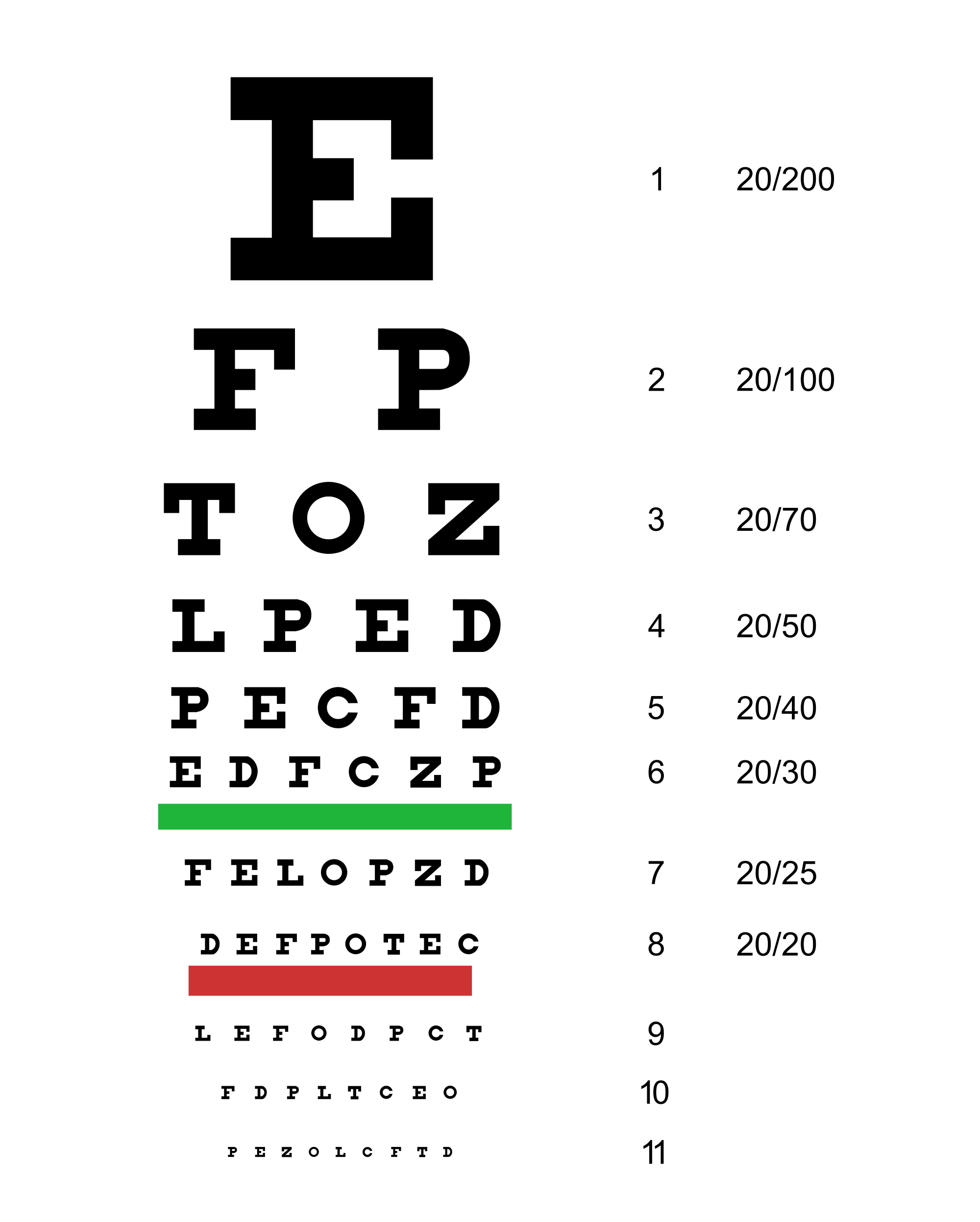 Látásvizsgálat, látásélesség vizsgálat menete (mi történik egy látásvizsgálaton) • idsign.hu